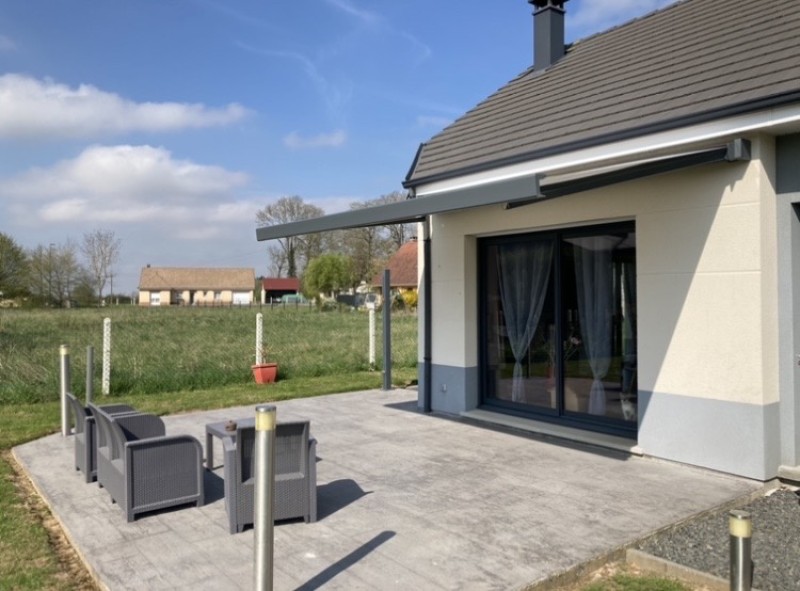 Protégez-vous et votre terrasse du soleil avec style grâce à notre store coffre en aluminium à Belmesnil entre Dieppe et Rouen